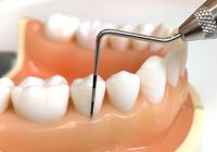 歯周組織検査の写真